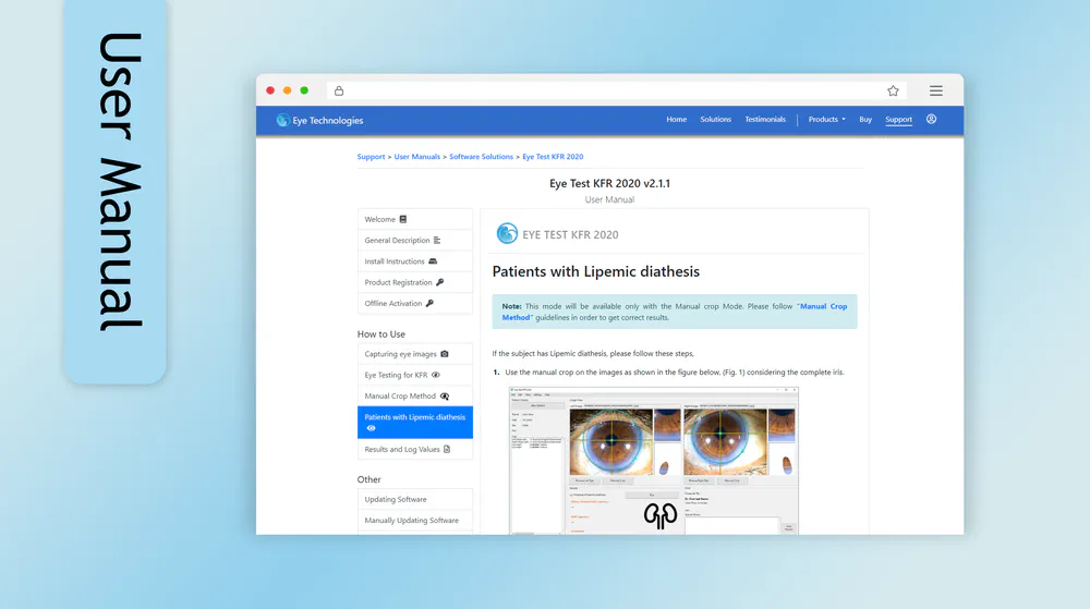 Eye Tech Lk Website User Manual